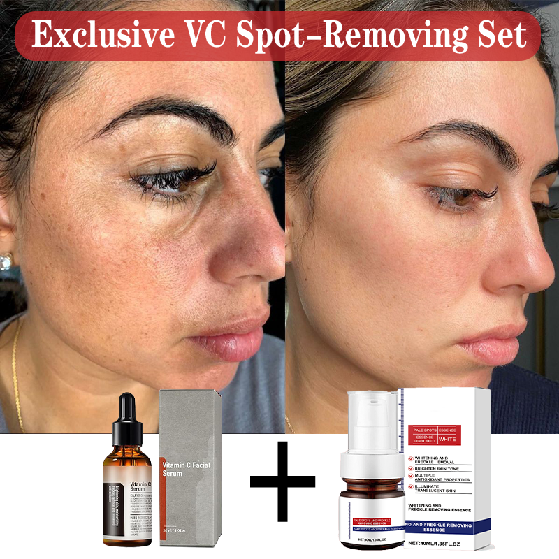 Set de Crema Blanqueadora y Correctora de Manchas VC
