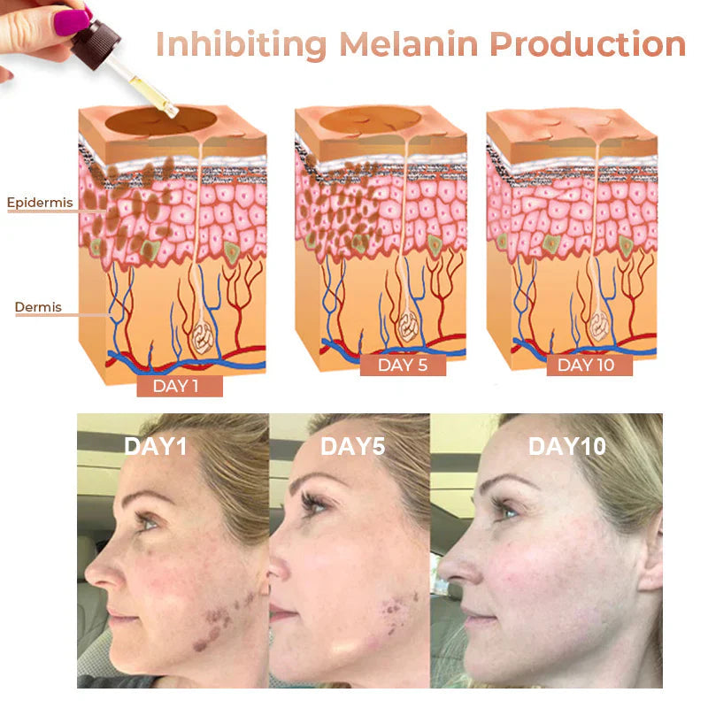 Set de Crema Blanqueadora y Correctora de Manchas VC