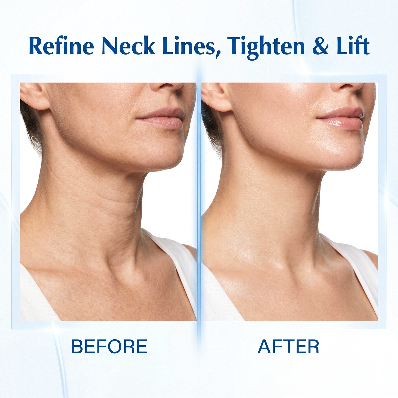 Neck Firming Roller Cream – Reduce Wrinkles & Tighten