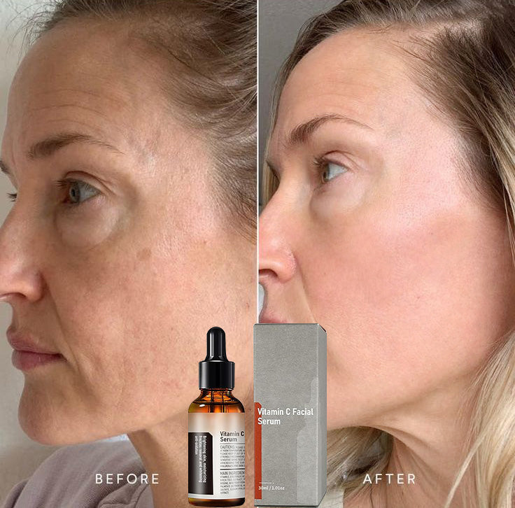 【Dermatologist-Recommended】 VC Spot-Correction & Whitening Cream Set