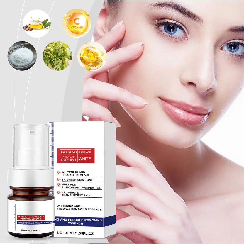 Crema facial blanqueadora de vitamina C para pecas, elimina el melasma, las manchas oscuras e ilumina la melanina